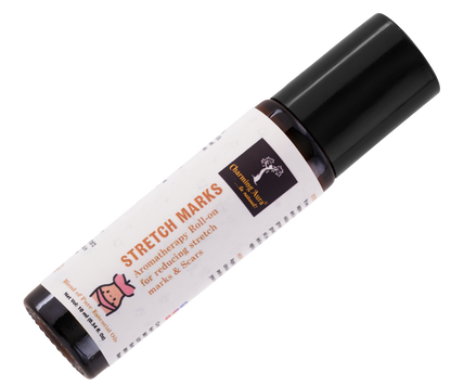 Stretch Marks Oil | Roll-on | Blend of pure essential oils, helps to reduce appearance of stretch Marks due to pregnancy, sports, weight fluctuation, Wrinkles |